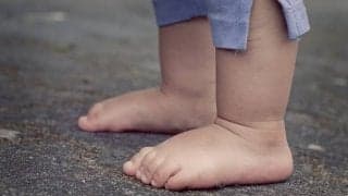 デスクワークや立ち仕事の方は要注意！むくみを感じていませんか？